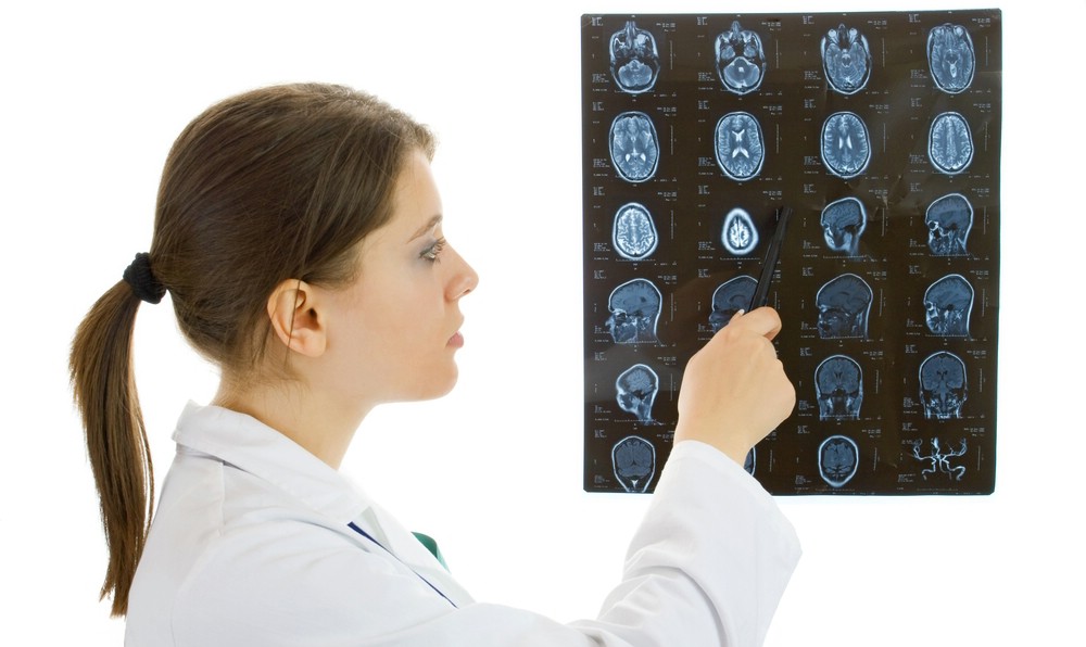 Basilar Skull Fracture - Hình ảnh minh họa